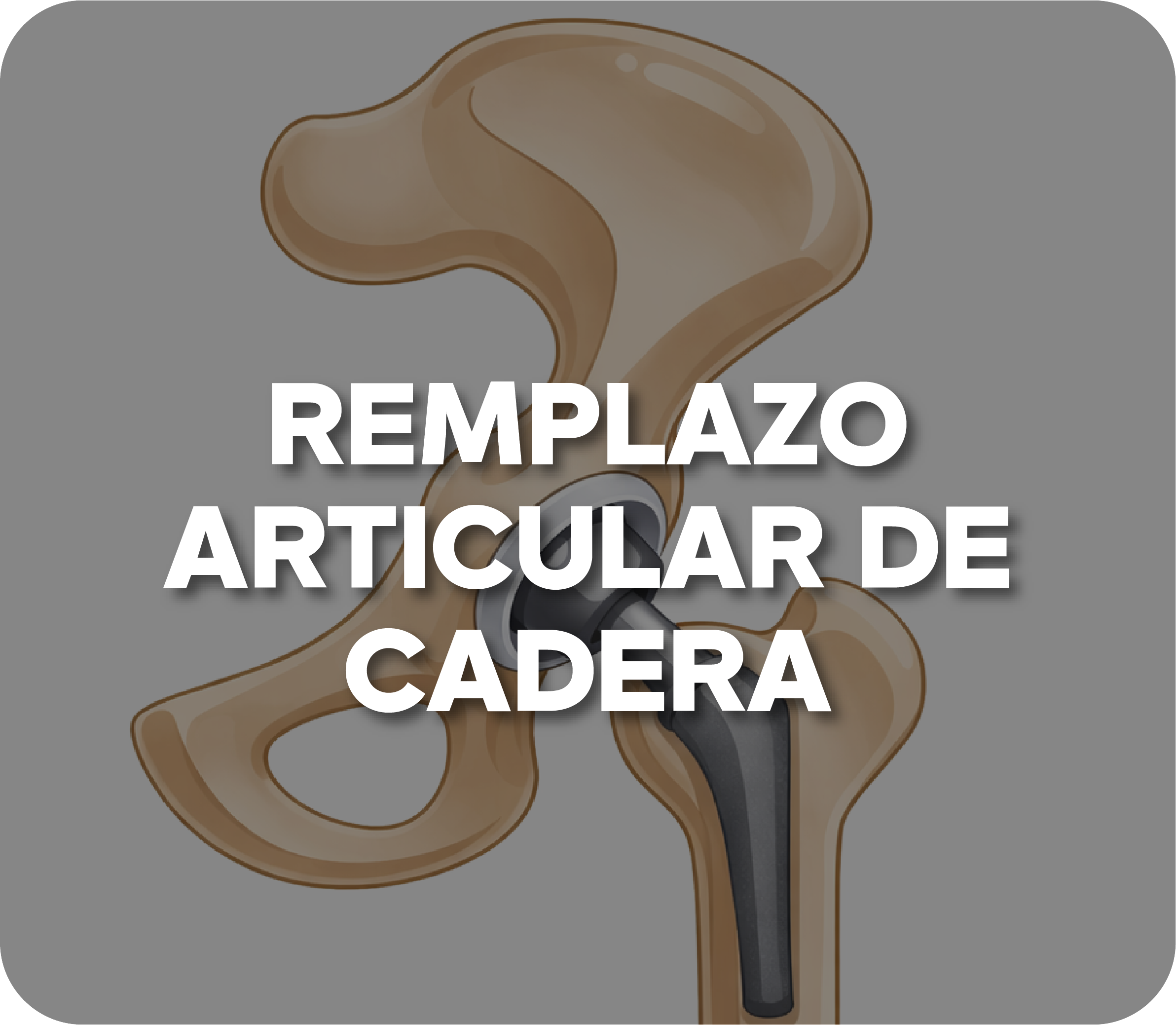 Luxación de hombro